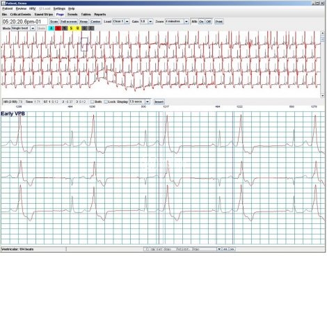 Software per Holter ECG NorthEast