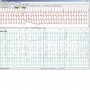 DH0060 - Software per Holter ECG NorthEast